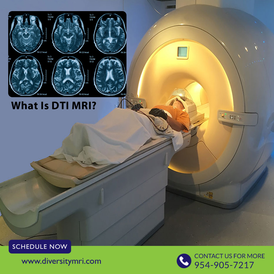 What Is Dti Mri Diffusion MRI And Its Role In Neuropsychology KDFT